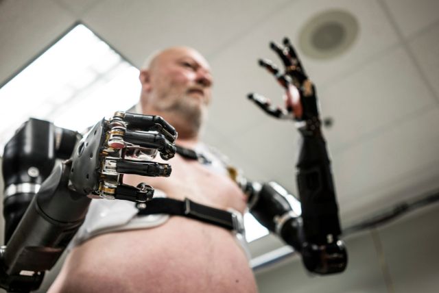 Robotic limbs disabilities