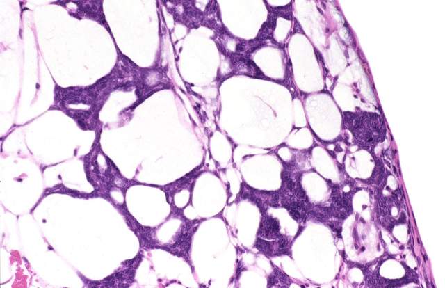 blastema cells forming at wound site